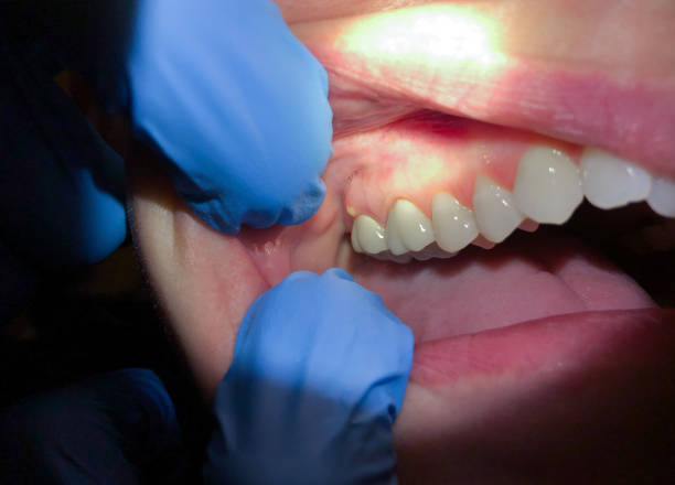 Best Emergency Dentist for Special Needs Patients in East Vineland, NJ